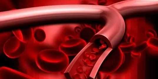 o型血為什么是萬能血,o型血為什么是萬能血圖3