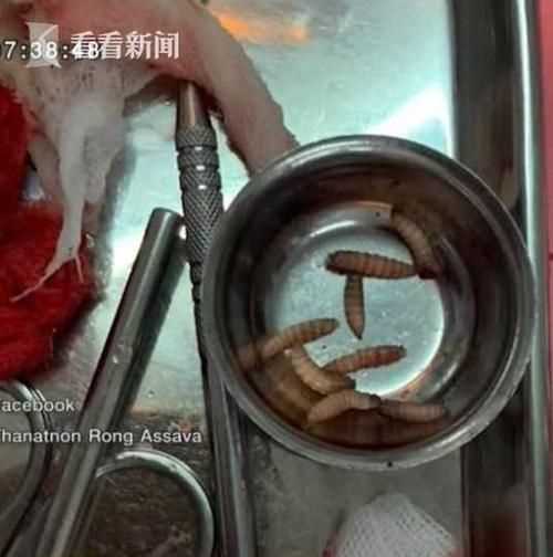 便池老有蛆爬出來怎么辦