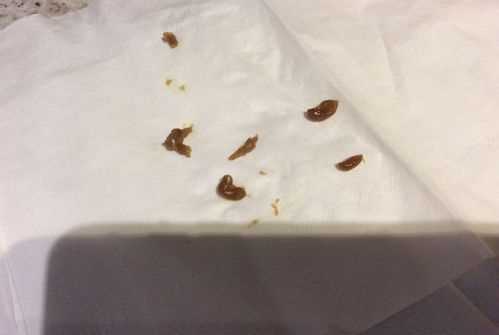 為什么會(huì)有蟑螂卵