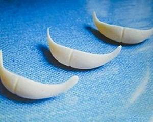 下巴取掉假體注意事項