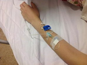 寶寶扎留置針注意事項(xiàng),貓咪扎留置針注意事項(xiàng),留置針的護(hù)理及注意事項(xiàng)