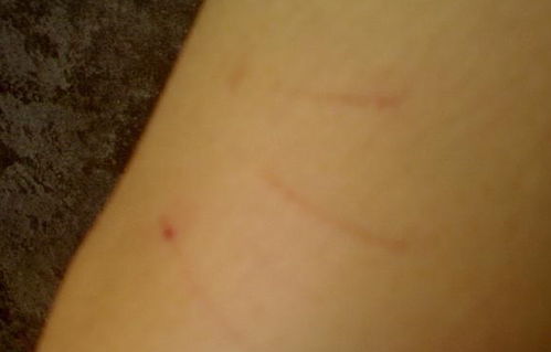 被貓抓傷注意事項(xiàng)