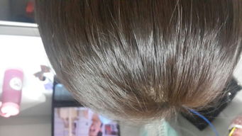 拉頭發(fā)后注意事項(xiàng)