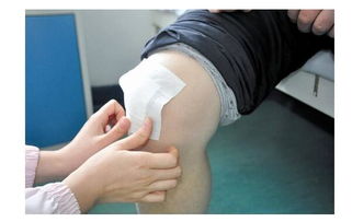 貼膏藥,注意事項(xiàng),有哪些