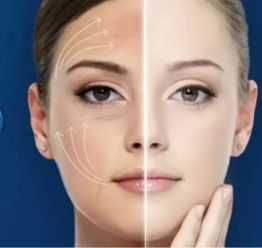 v臉提升注意事項(xiàng)