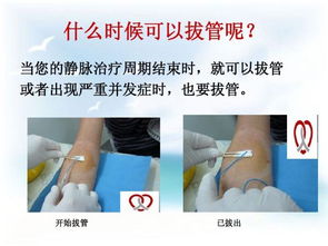 PICC使用注意事項及換藥流程,picc使用注意事項最新指南,picc使用注意事項PPT