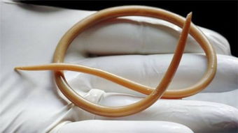 驅(qū)蛔蟲注意事項