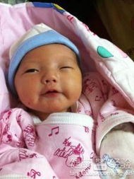 引流黃疸后注意事項