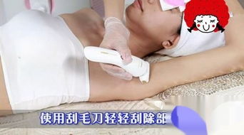 脫毛,激光,注意事項