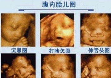 做排卵彩超前注意事項(xiàng)