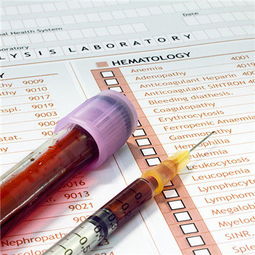 血粘度高的飲食注意事項(xiàng),驗(yàn)血粘度注意事項(xiàng),粘度的測(cè)定注意事項(xiàng)