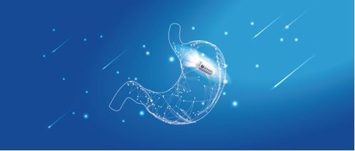 做胃部彩超注意事項