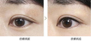 眼線,需注意,事項(xiàng)