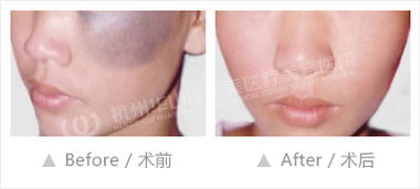 上海,注意事項,激光,第九人