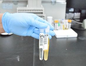 尿標(biāo)本收集的注意事項(xiàng),尿標(biāo)本的收集和保存注意事項(xiàng),尿標(biāo)本采集的注意事項(xiàng)