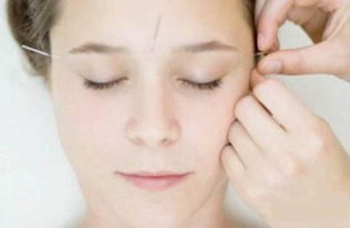 針灸起針方法和注意事項,針灸后注意事項,針灸注意事項和禁忌癥