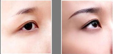 做眉毛之后注意事項