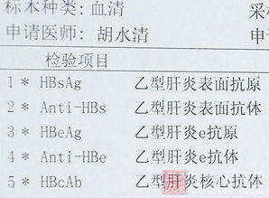 乙肝,五項(xiàng),注意事項(xiàng),檢查