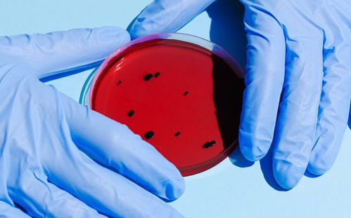 傳染病標(biāo)本采集注意事項(xiàng),春季傳染病注意事項(xiàng),冬季傳染病注意事項(xiàng)