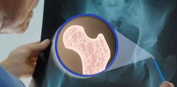 密固達(dá)使用后注意事項