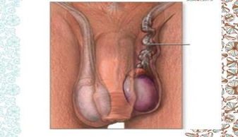 睪丸切除術(shù)前注意事項