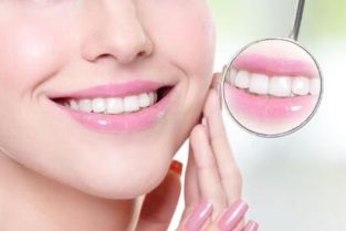 烤瓷牙按完之后注意事項(xiàng),烤瓷牙鑲牙后注意事項(xiàng),烤瓷牙的注意事項(xiàng)