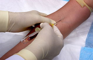 胸腔灌注化療注意事項(xiàng),胸腔內(nèi)化療注意事項(xiàng),胸腔灌注化療藥注意事項(xiàng)