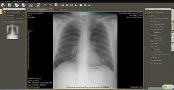 醫(yī)學影像基礎概論前五章知識點