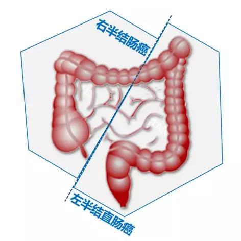 結直腸癌基礎知識